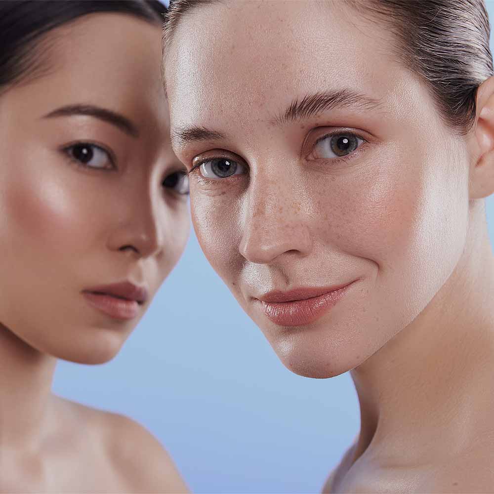 Mesotherapy Treatment Cheshire